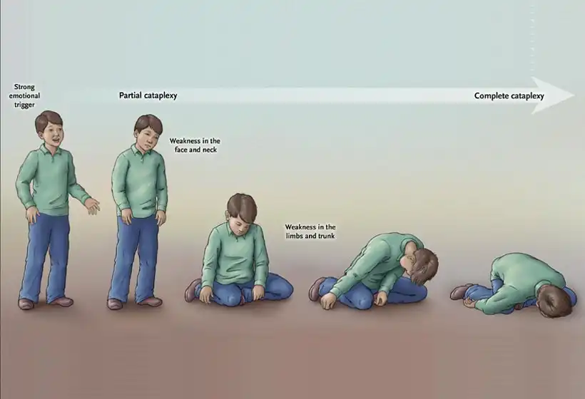 What Is Cataplexy?